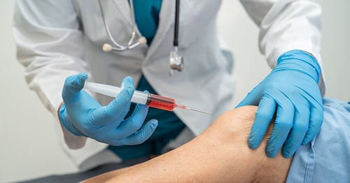  PRP THERAPY